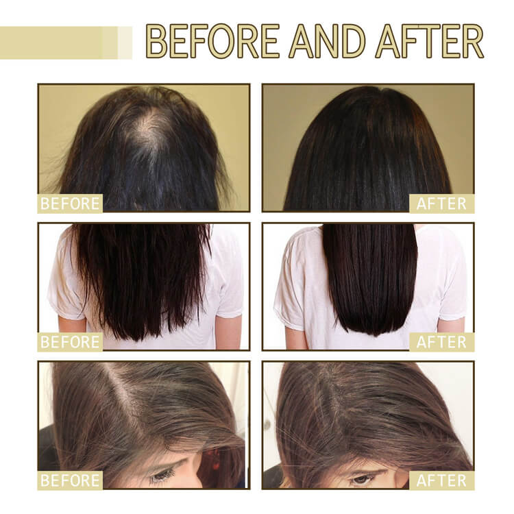 eelhoe hair growth oil,reviews,How to use,before and after,BUYS